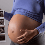 Different stages of pregnancy | Phoenix Health Care Group Medical Clinic in Edenvale