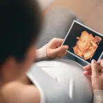 4D Ultrasound Scans
