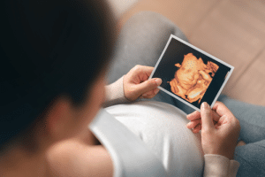 4D Ultrasound Scans