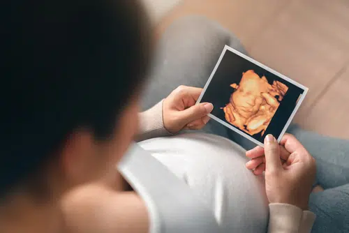 4D Ultrasound Scans