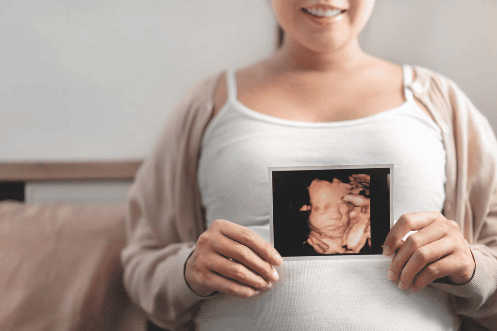 4d ultrasound 